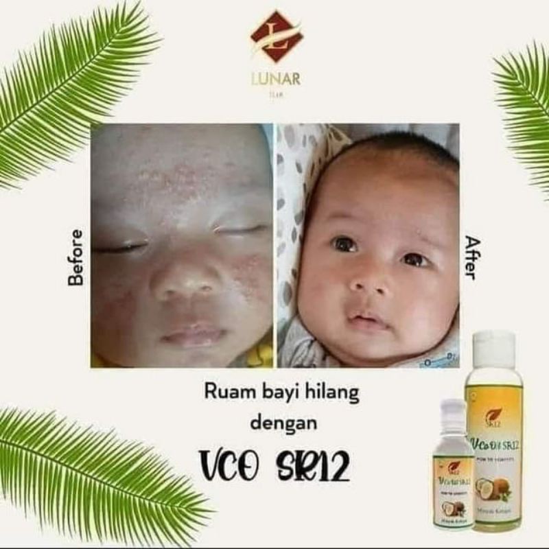 VCO SR12 Untuk Bayi VCO untuk ruam pada bayi VCO Oil Original BPOM