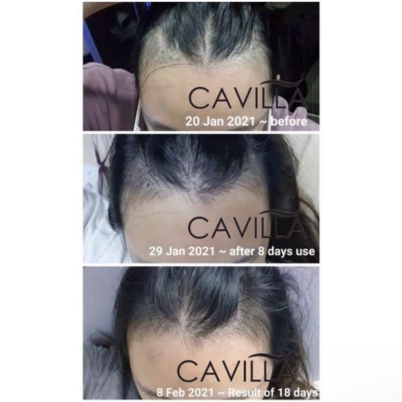 Heygan - CAVILLA HAIR TONIC / SERUM PENUMBUH RAMBUT RONTOK CEPAT ALAMI / CAVILLA EYELASH SERUM