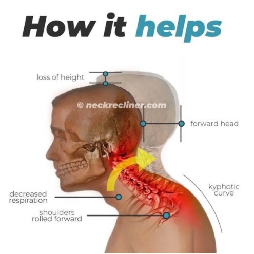 Alat Terapi Tengkuk Leher, NECKCARE