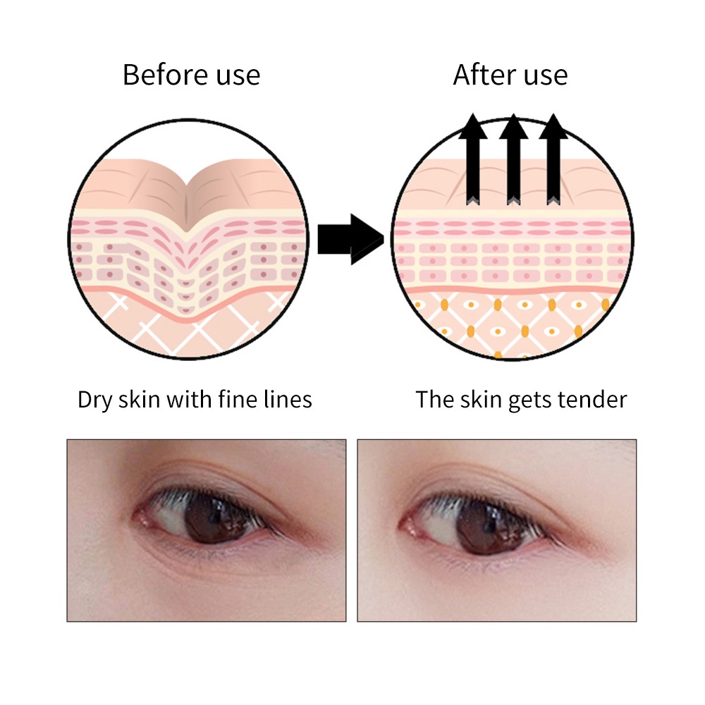 ALLPHV Retinol Hydra Gel Collagen Eye Mask Patches 60 Pcs