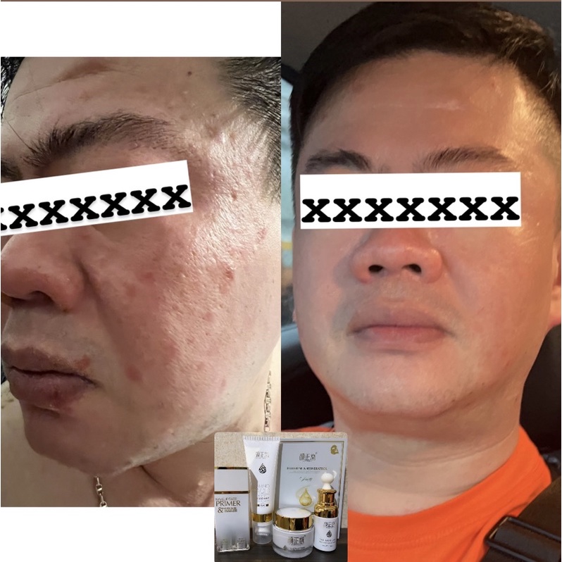 skin care Yan Zheng Tang u dan masalah kulit wajah lain nya, bikin awet muda hilang kan flek, jerawa