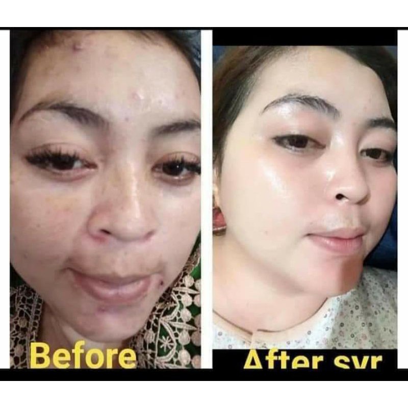 Bisa cod bpom skincare cream paket lengkap syahreni glowing set krim siang malam ori syahraeni syr-6