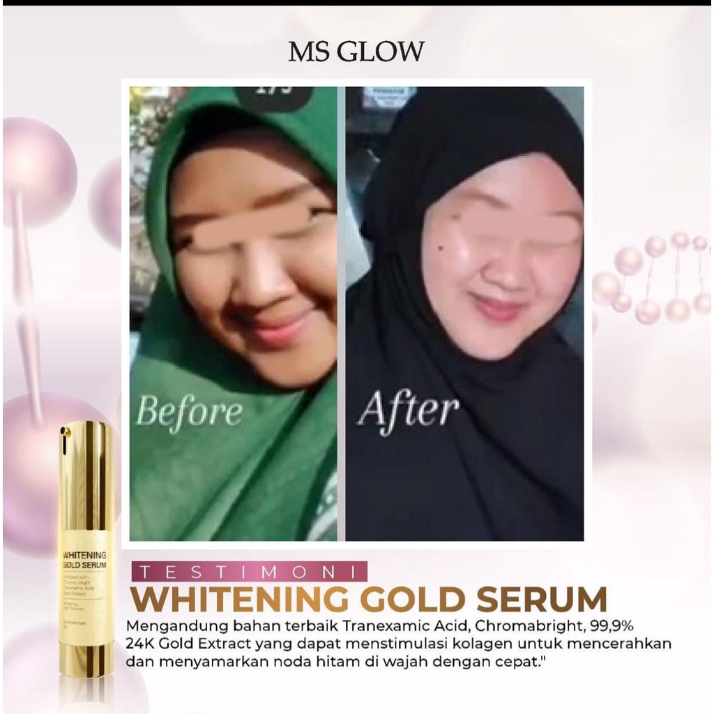 MS GLOW SERUM ACNE, SERUM LUMINOUS, SERUM WHITENING, SERUM PEELING ORIGINAL 100%