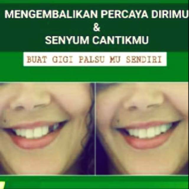 Gigi Palsu Buat Sendiri / Gigi Palsu