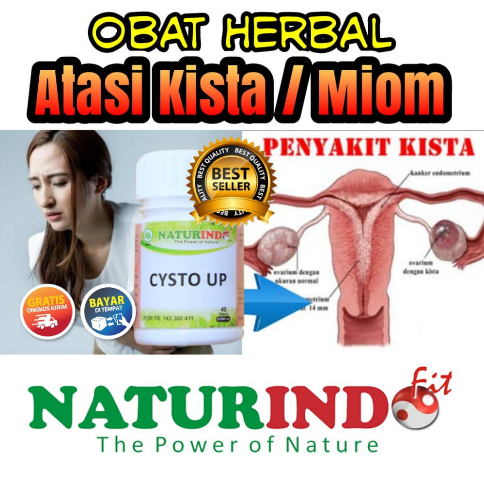 Obat sakit kista ovarium bengkak cysto up bagi penderita kista ampuh Cysto up naturindo COD
