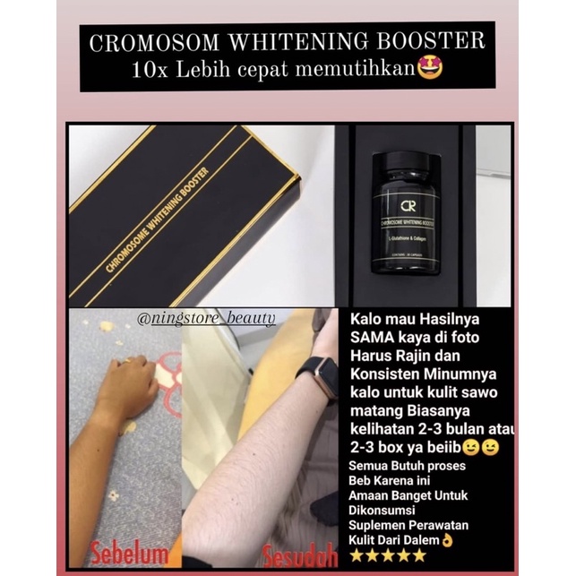 CHROMOSOME WHITENING BOOSTER ( NEW HOLO EMAS ) ORI BOX SEGEL / CROMOSOME WHITENING BOOSTER || SUPLEMEN PEMUTIH AMPUH || CROMOSOME CHROMOSOM KROMOSOM ORIGINAL