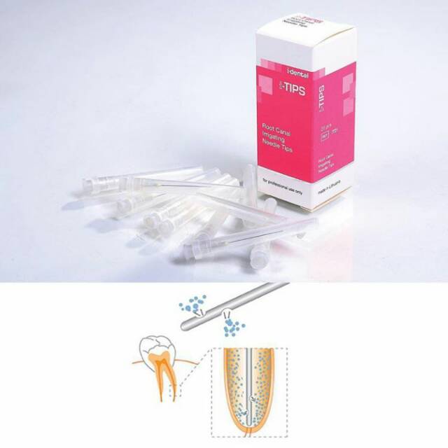 Endo needle i-tips i tips 2 holes 30G jarum irigasi lubang samping saluran akar irrigation