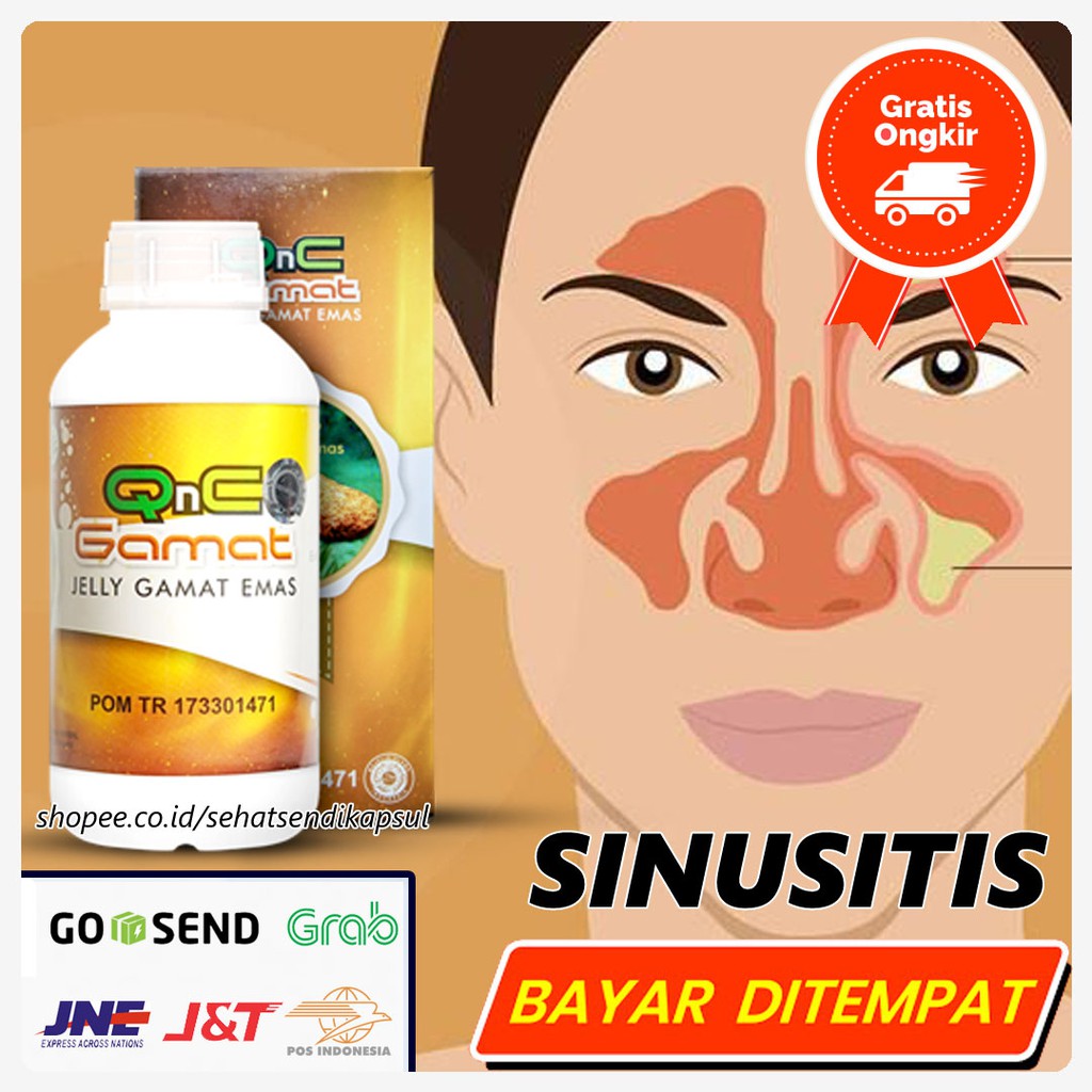 Obat Sinusitis Kronis dan Akut - Radang Sinusitis - Infeksi Sinusitis