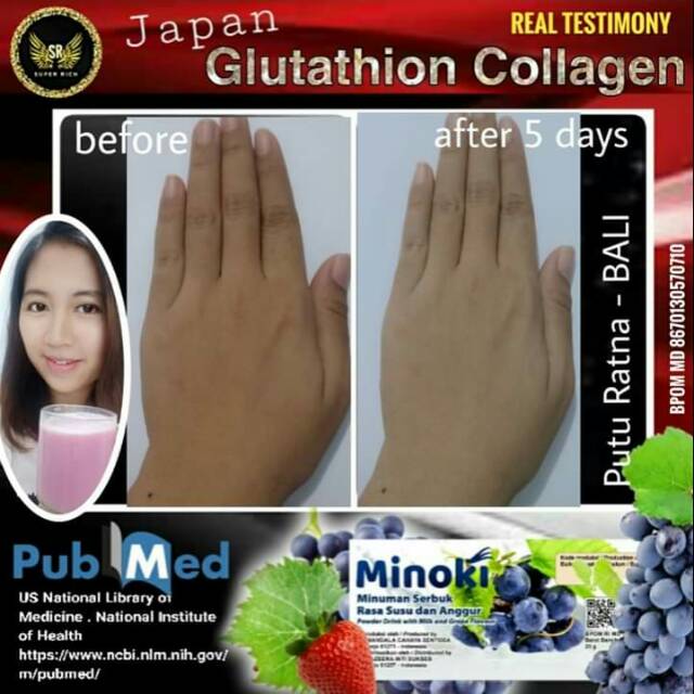Minoki collagen