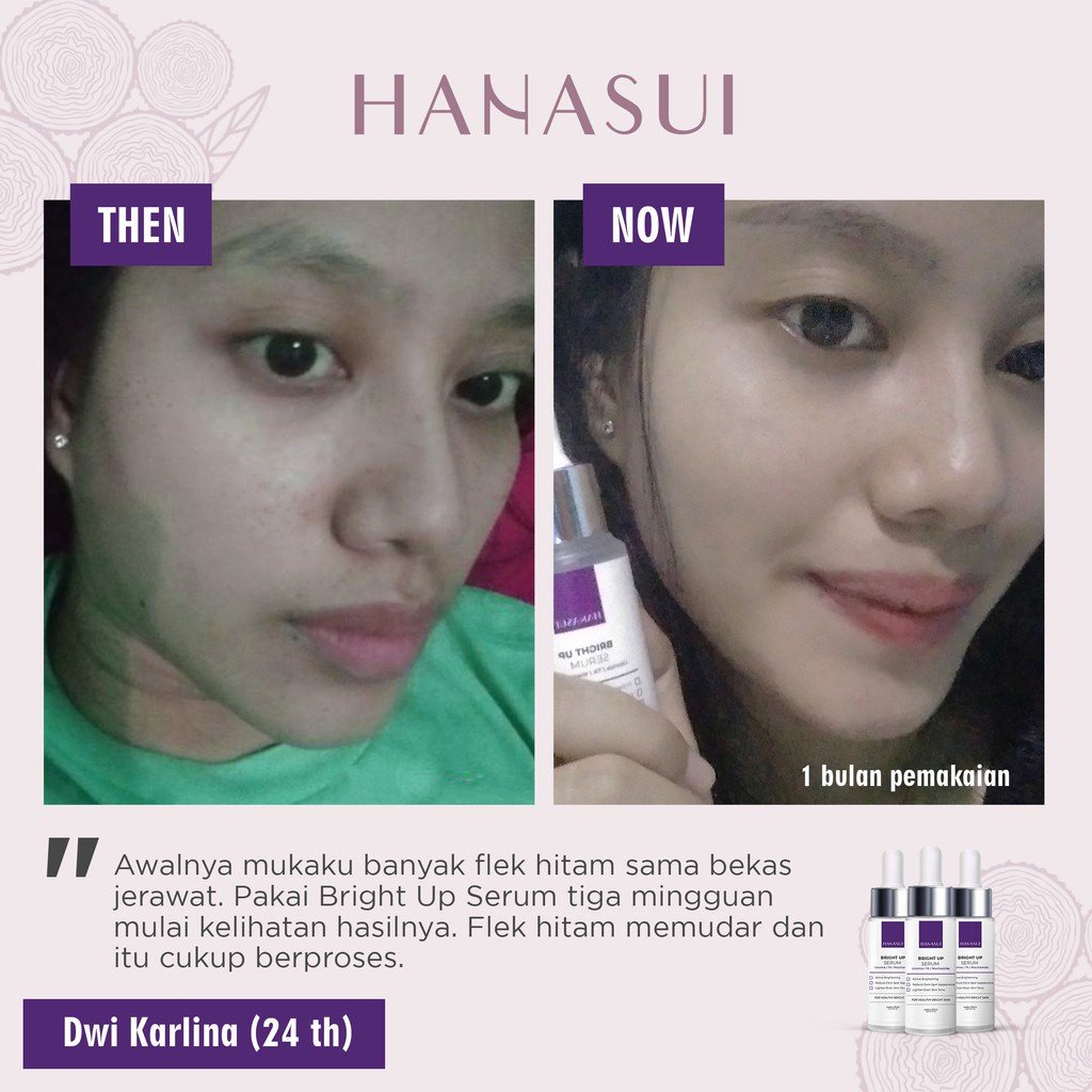 Hanasui Bright Up Serum Hanasui Intense Treatment Serum