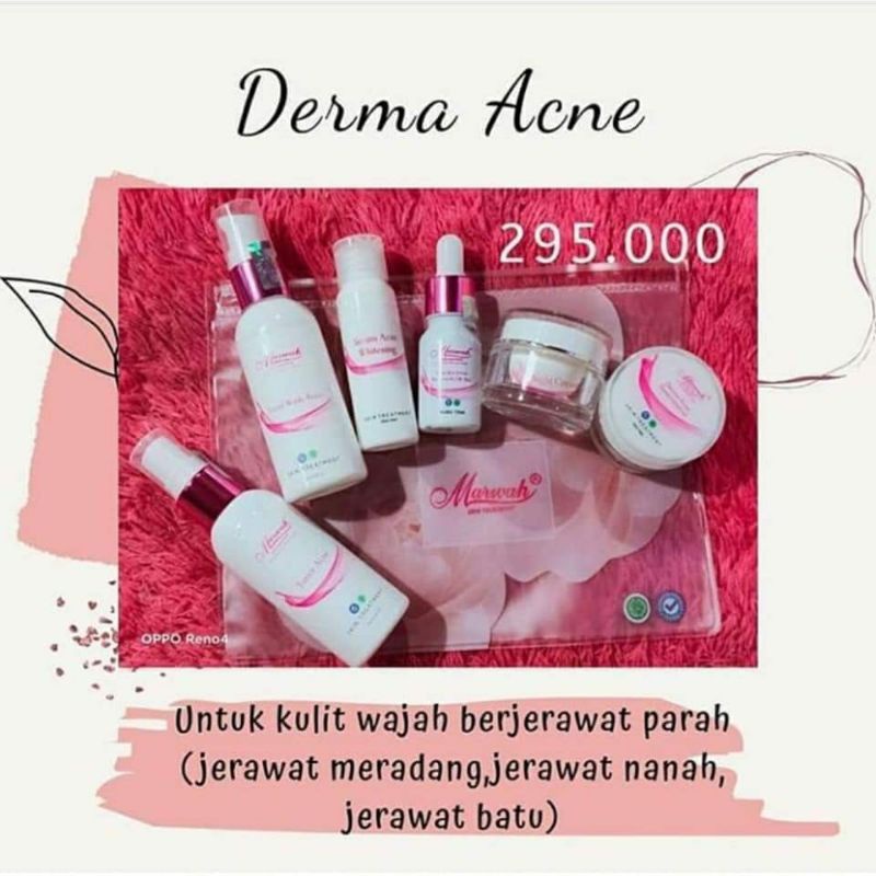 [FREE GIFT] DERMA ACNE MARWAH SKINCARE