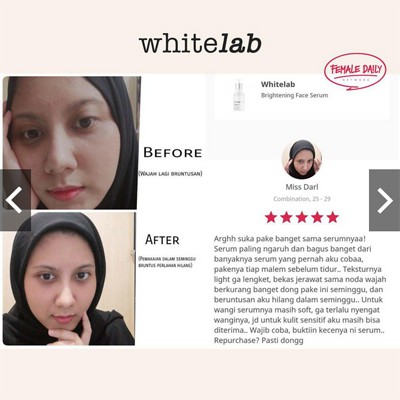 [FREE GIFT] Whitelab Skincare  - Whitelab Face Serum - Whitelab Face Toner - Whitelab Face Wash