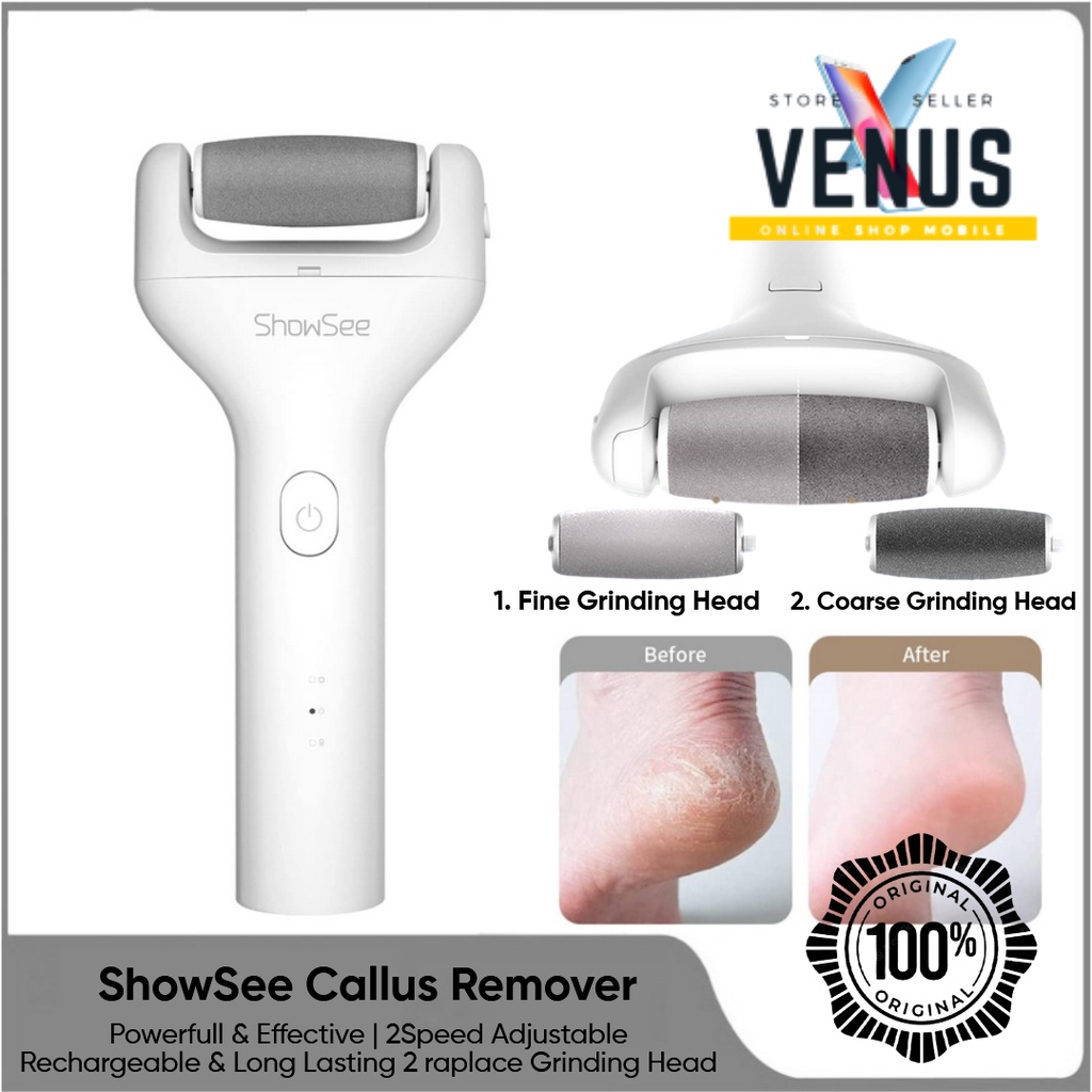 ShowSee Callus Remover Electric Pedicure Dead Skin Remover for Feet