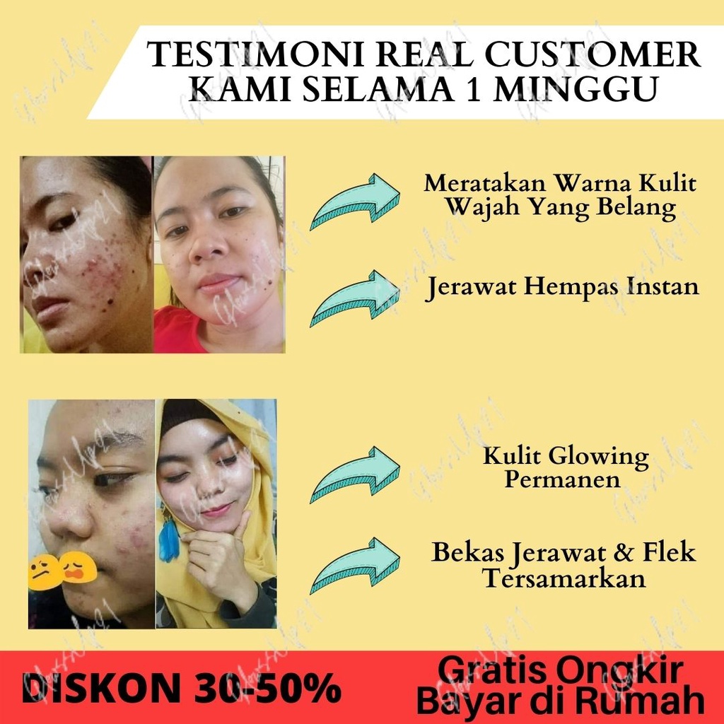 CREAM PENCERAH WAJAH KRIM PEMUTIH WAJAH PENGHILANG FLEK JERAWAT - CB CREAM KOREA ORIGINAL