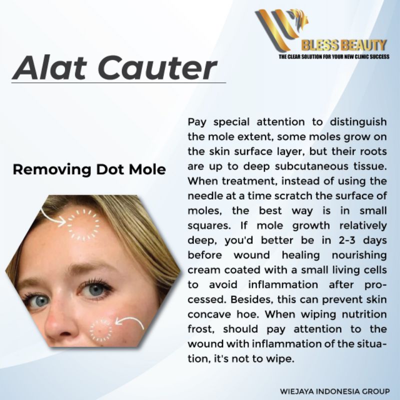 Alat Penghilang Black Spot Tatto Kutil Flek Melasma Soft Cauter Removal