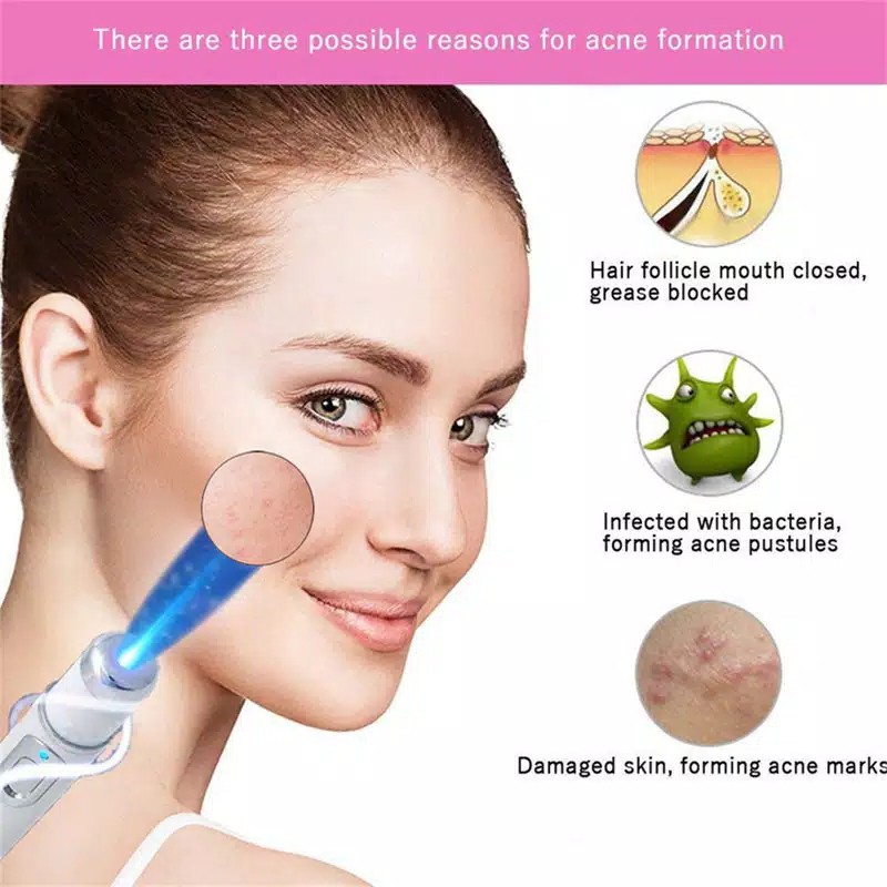 Acne Laser Pen Facial Massager Treatment Soft Scar