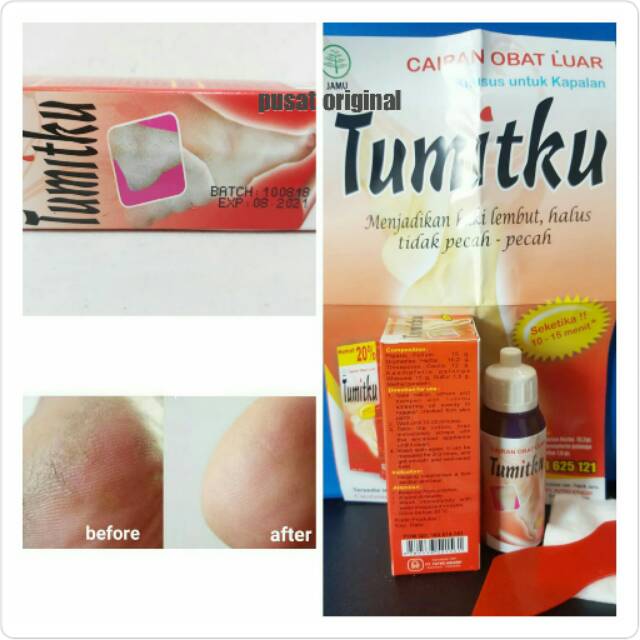 

TUMITKU MENGATASI KAKI KERING KASAR PECAH-PECAH / KAPALAN SECARA INSTAN BPOM