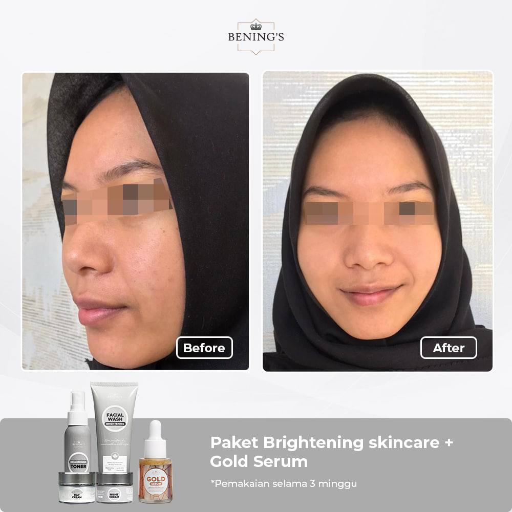 Bening Skincare Dr Oky Pratama Paket Brightening Terbaik (Free Gift) Benings Skincare - Benings Clinic Paket Pencerah-7