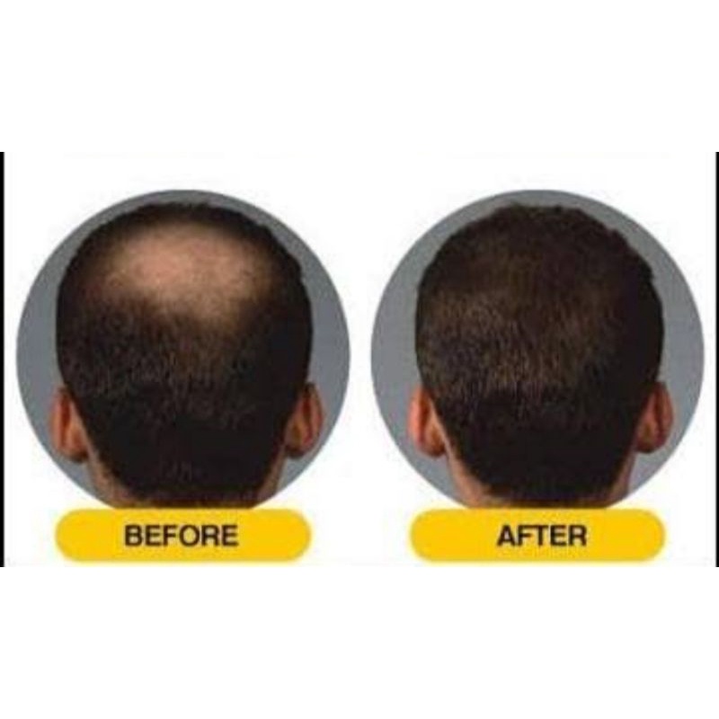 HAIR TONIC GINSENG ASLI anti rontok penumbuh rambut menyuburkan rambut penguat rambut-2
