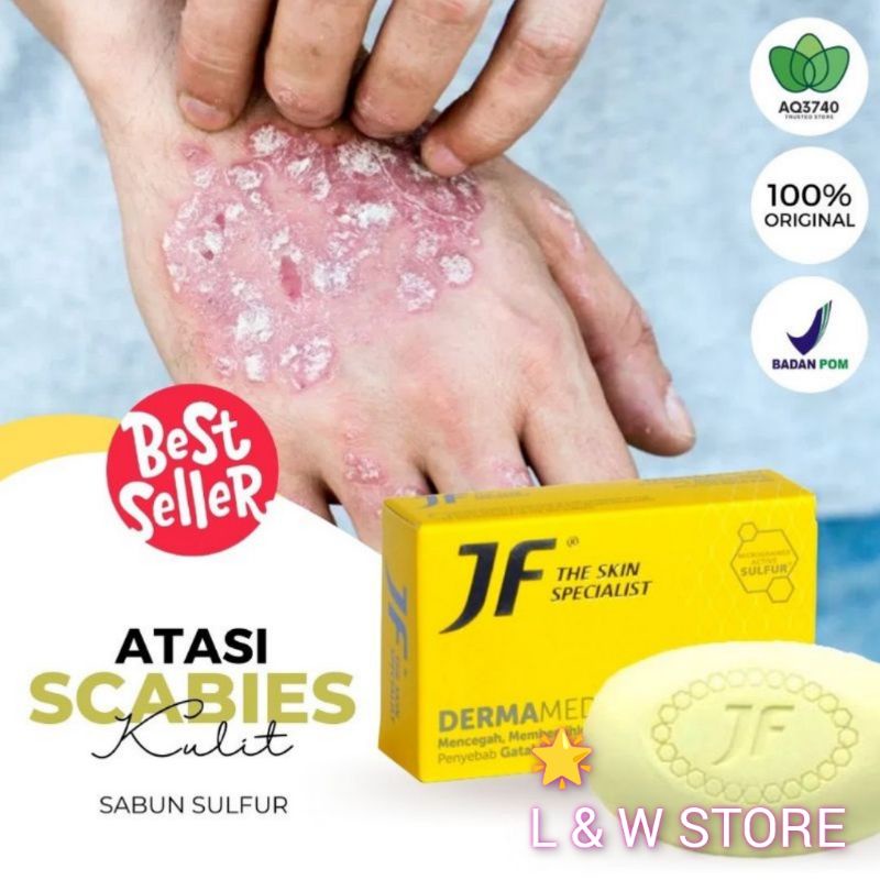 JF SULFUR SABUN MUKA/JF SULFUR ANTI ACNE/Sabun Wajah