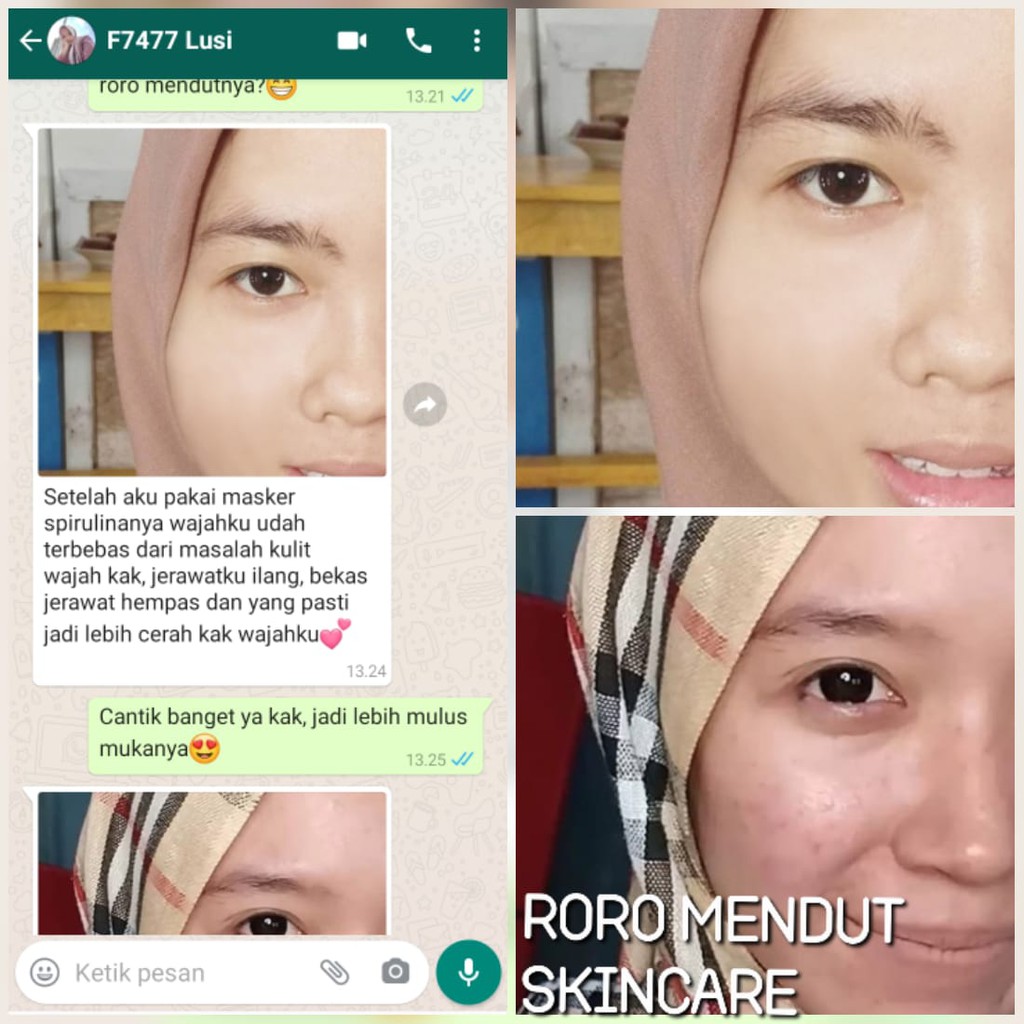 Roro Mendut Masker Spirulina Mini Size 20 gr Whitening Pemutih Wajah Penghilang Jerawat Bopeng Flek