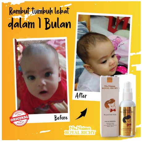 Naufa Royal Richy Serum Rambut Subur Penumbuh Rambut Bayi Dan Anak Kualitas Premium