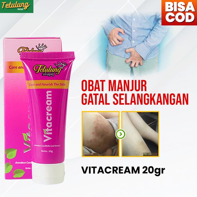 

Discount Salep Vitacream Obat Herbal Gatal Alami untuk Selangkangan, Wasir /OBAT HERBAL ASAM URAT/OBAT HERBAL PELANGSING/OBAT HERBAL KOLESTEROL/OBAT HERBAL DIABETES