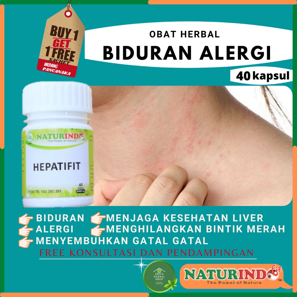 Obat Gatal Biduren