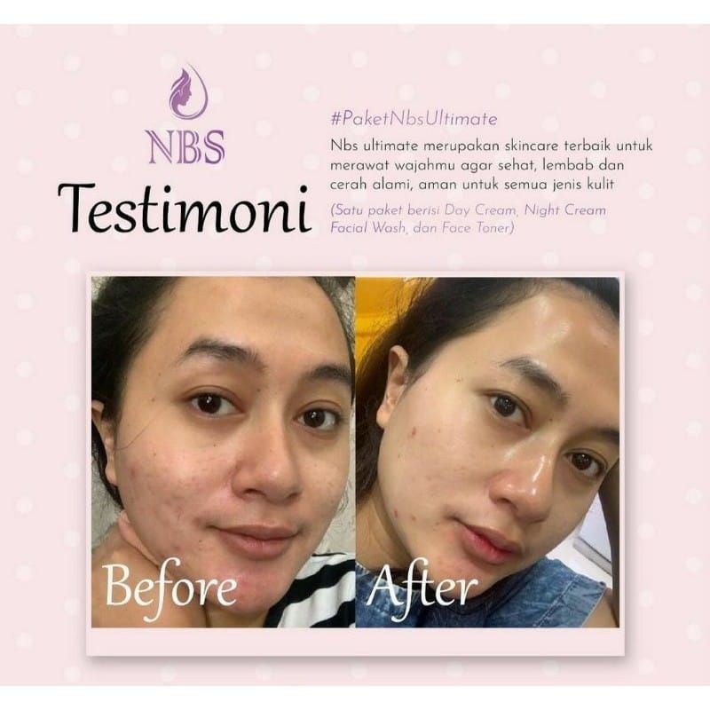 NBS SKINCARE ULTIMATE NEW