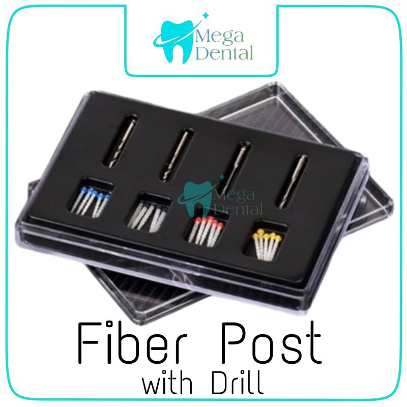 Jual DENTAL FIBER POST / DENTAL PASAK GIGI ENDODONTIC Shopee Indonesia