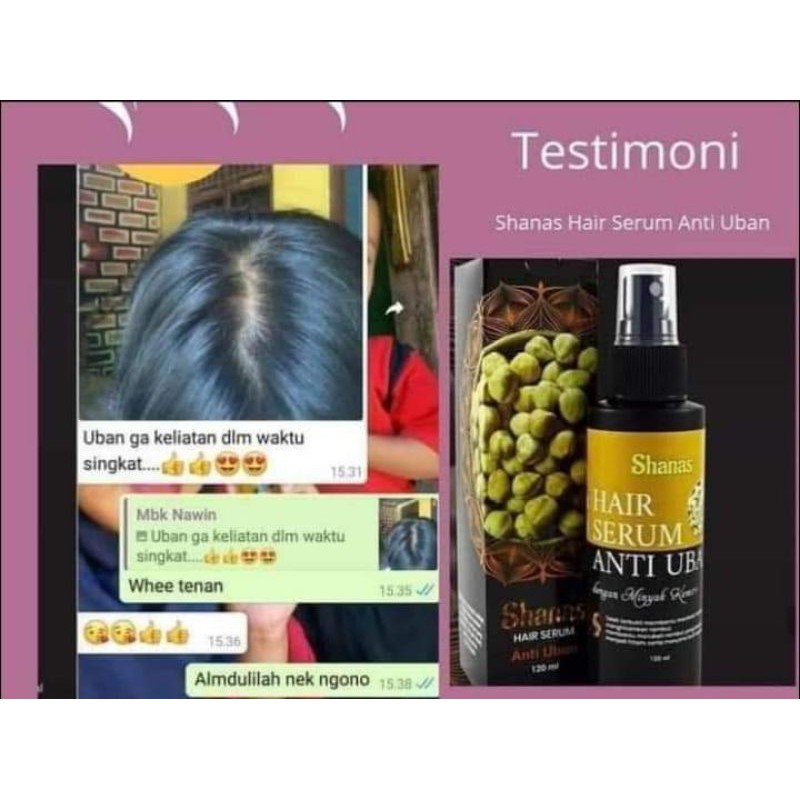 SERUM ANTI UBAN / TERLARISS / AMPUH MENGHITAMKAN UBAN TANPA SEMIR