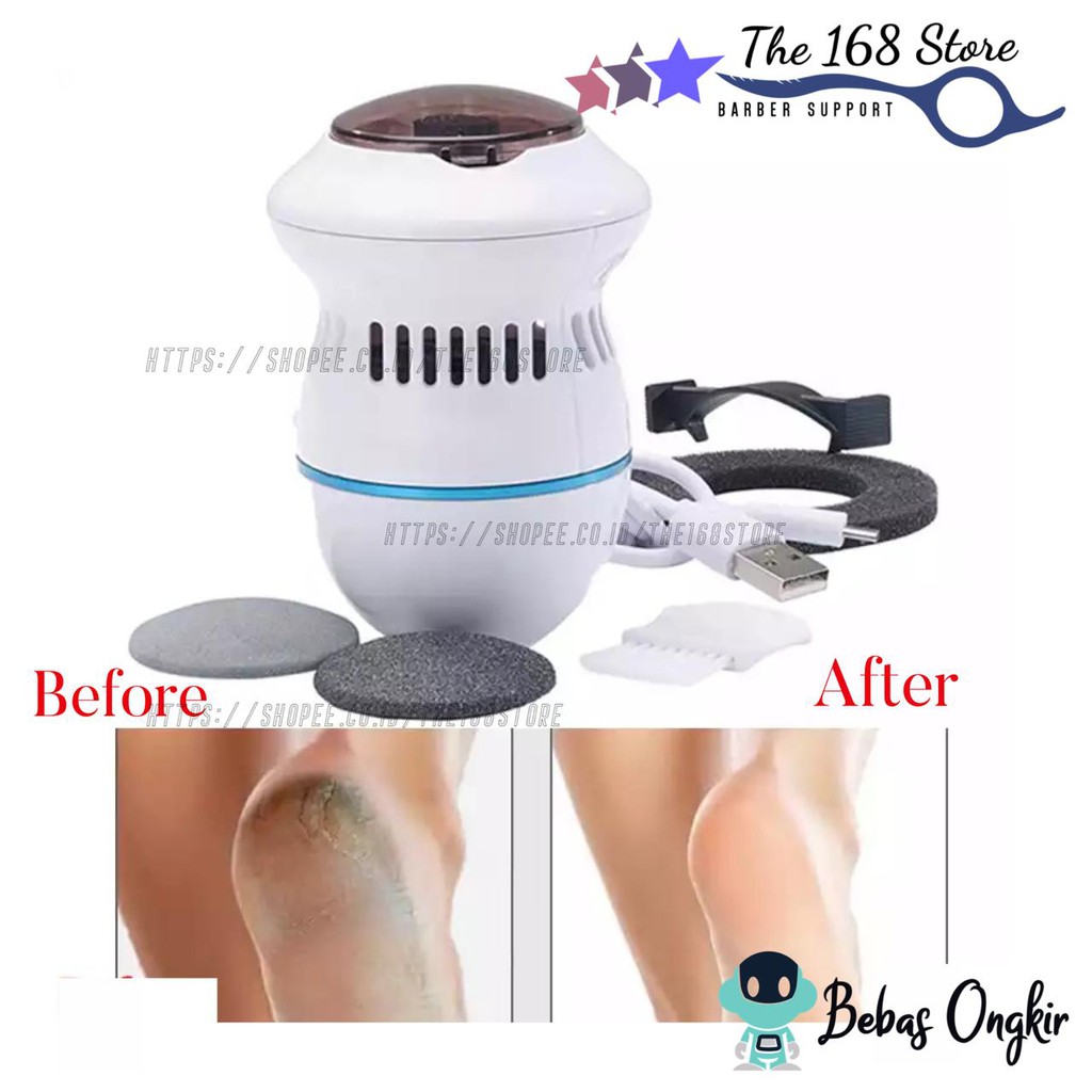 Pedi Vac Perawatan Kaki Pembersih / Remover Tumit Kaki Rechargeable