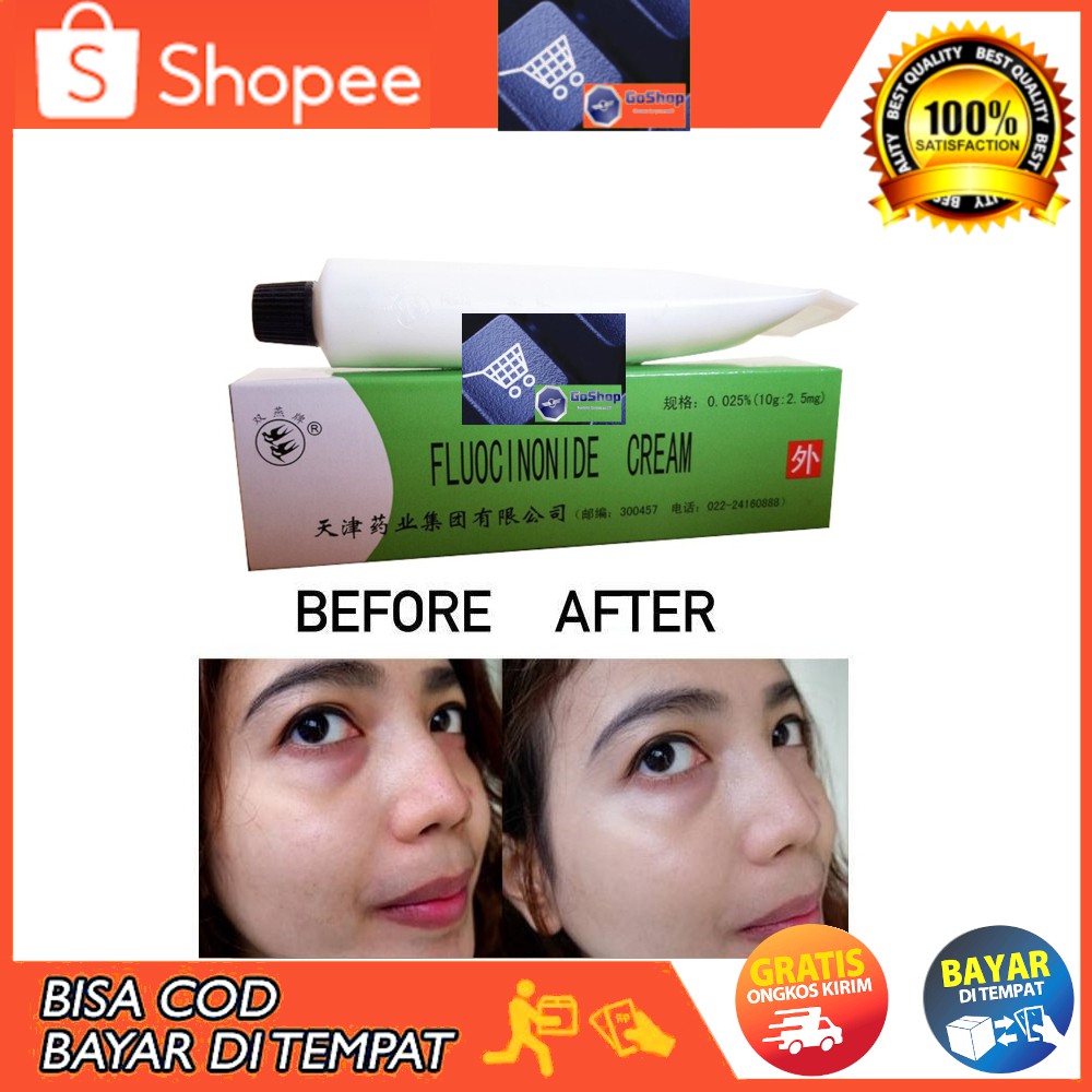 GoShop Cream / Salep Cina Ampuh Penghilang Flek Hitam Membandel Di Wajah Paling Ampuh Permanen