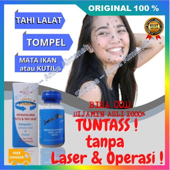 [BISA COD] PROMO BELI 2 GRATIS 1 Salep Kutilang Salep Tahi Lalat, Kutil & Daging Tumbuh Ampuh 100% O