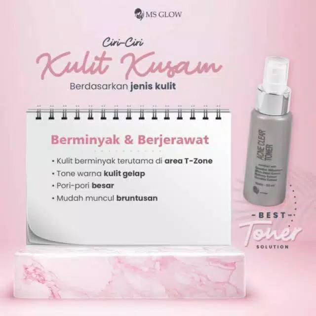 MS GLOW ACNE TONER/FACE TONER