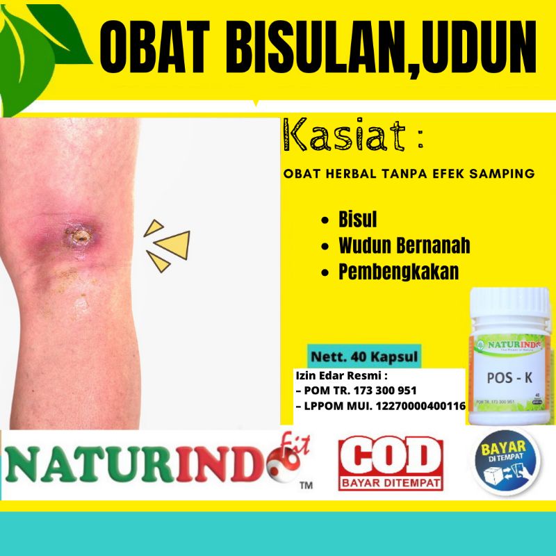 Obat Bisul Bernanah Ampuh Wudun Di Mata Wajah Pantat