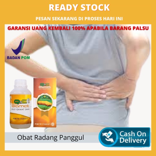 Obat Radang Panggul Herbal, Radang Panggul, Obat Sakit Panggul Belakang, Infeksi Radang Panggul, Oba