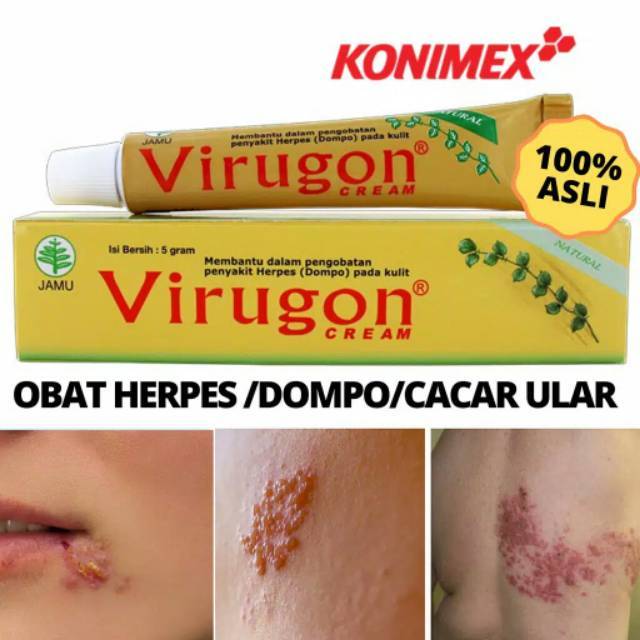 Salep Virugon Untuk Herpes Atau Dompo Atau Cacar Ular Shopee Indonesia
