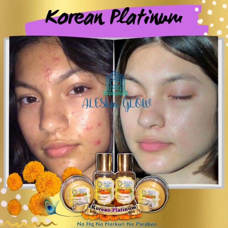 KOREAN PLATINUM ALESKIN GLOW Skincare Glowing-Paket Perawatan Wajah Korea-Cream Glowing-Cream Pemutih Wajah