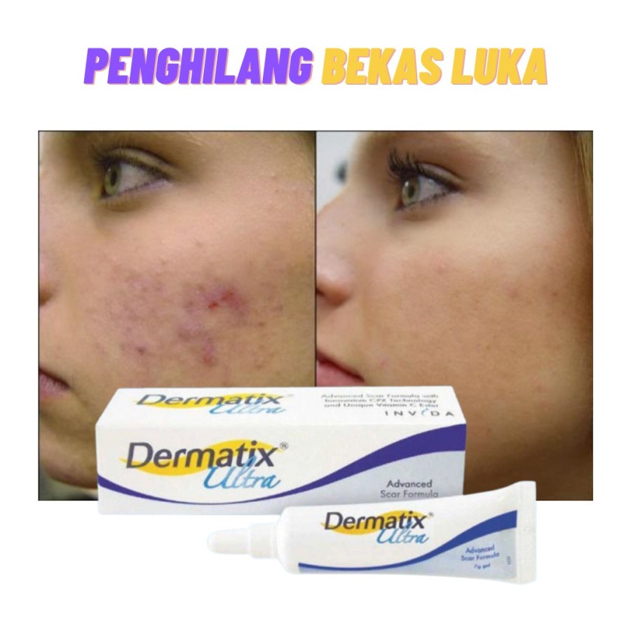 Dermatix Ultra Obat Penghilang Bekas Luka Salep Bekas Luka 15gr