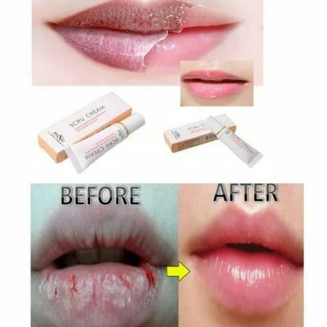 Ready Cream Bibir Mengatasi Kulit Mati