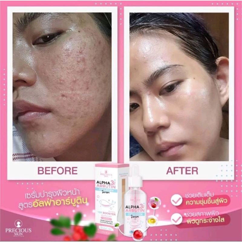 ALPHA ARBUTIN 3plus COLLAGEN SERUM FACE