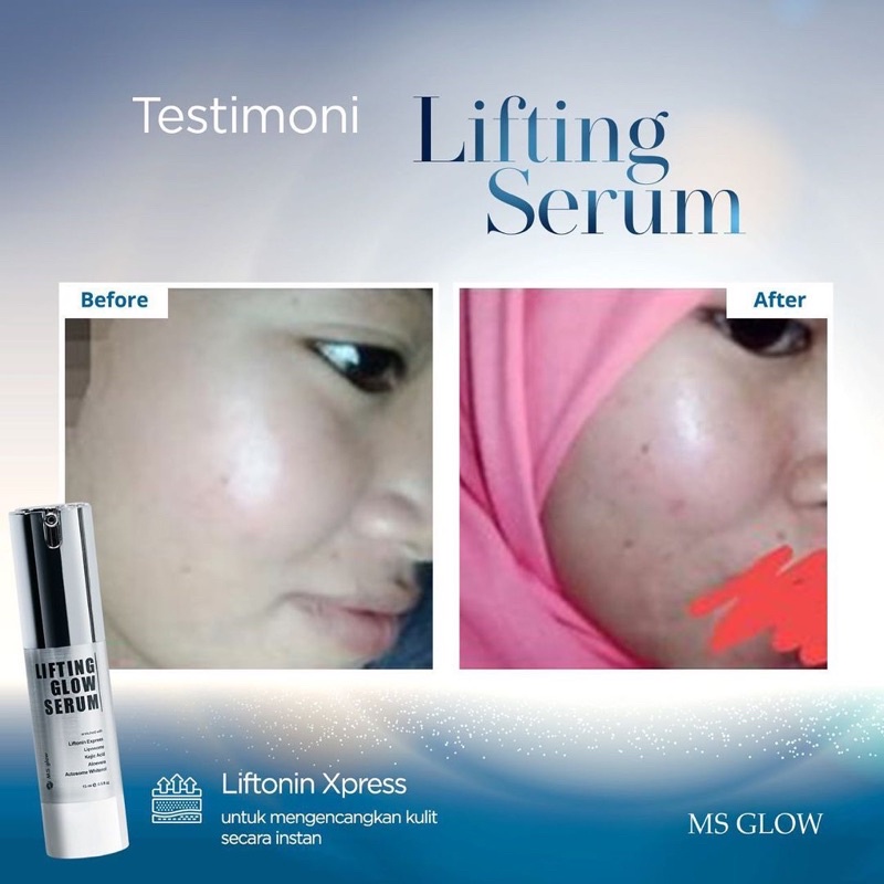 Original SERUM LIFTING MS GLOW