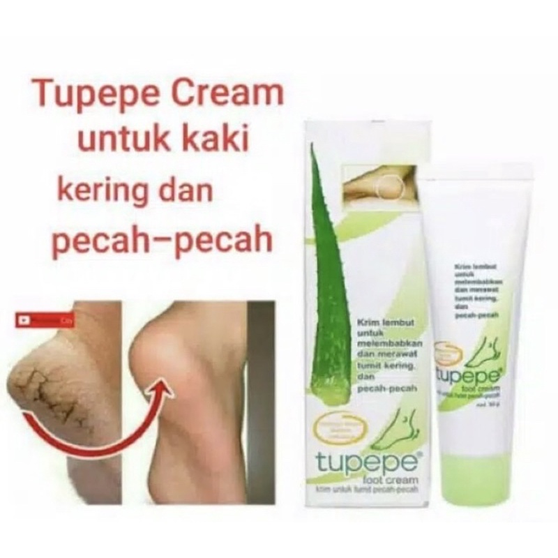 Tupepe foot cream 30 gram ( krim tumit pecah2 )