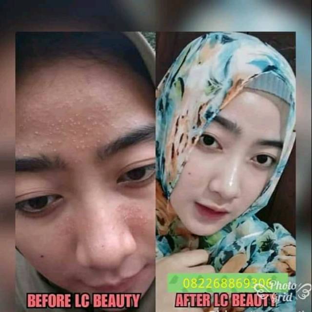 Lc beauty/kf skin/Paket lc beauty