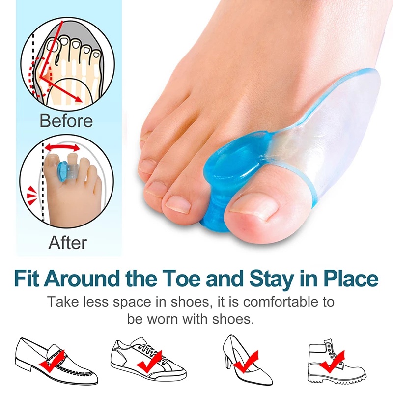 1Pair Silicone Gel Bunion Big Toe Separator Spreader