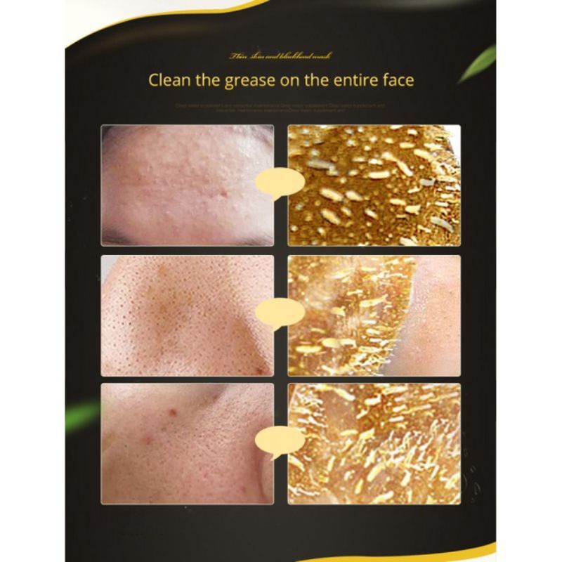 Medan Termurah by Images Masker komedo emas kolagen Gold collagen mask blackhead remover