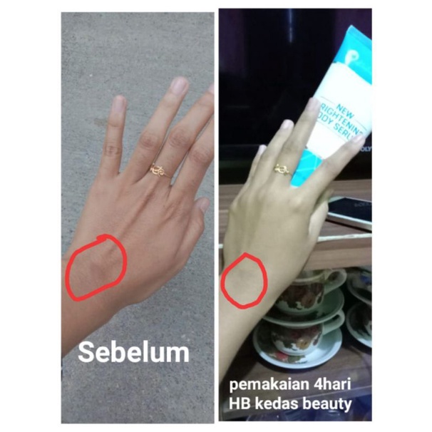 PROMO Body Serum Kedas Beauty Original 100%-3