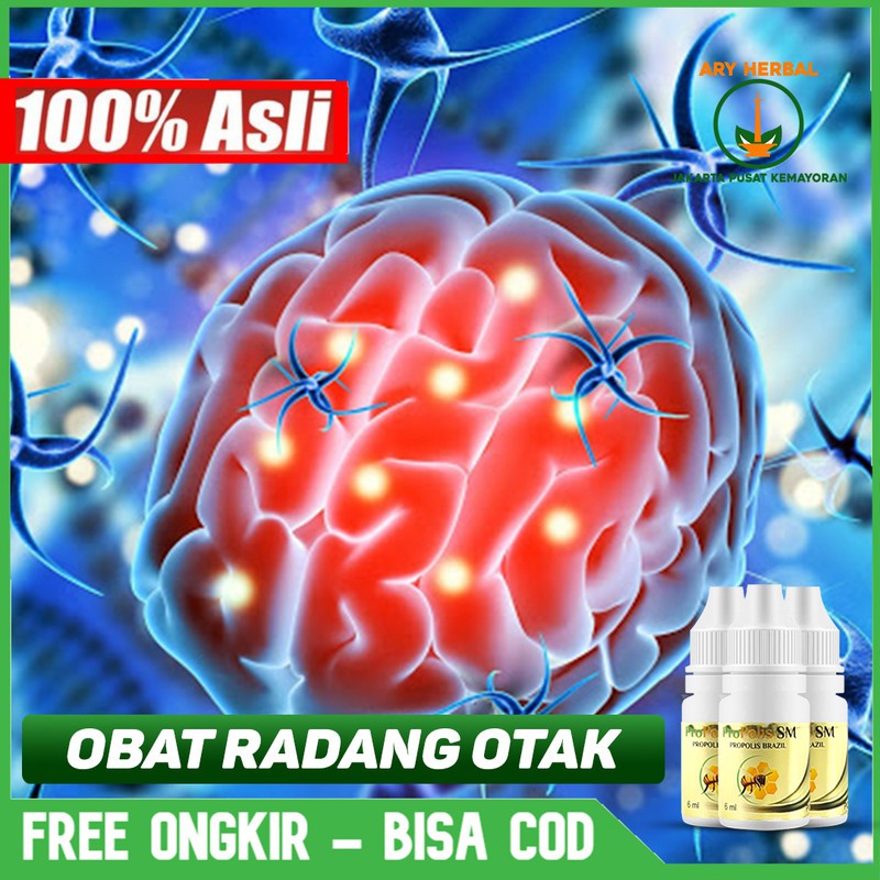 

Obat Radang Otak, Sakit Kepala, Geger Otak Alami Herbal Terlaris Propolis SM Bisa COD