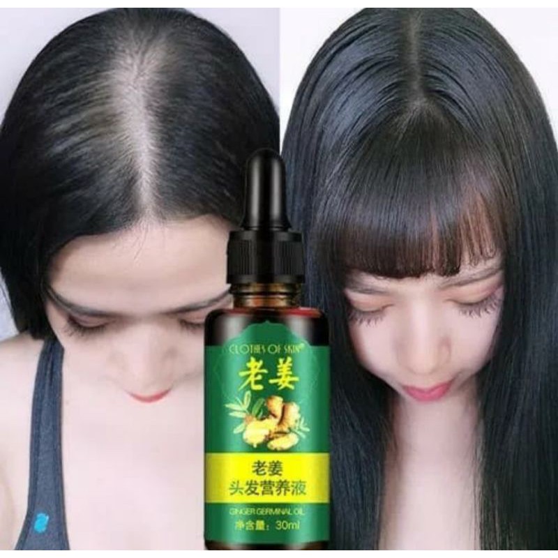 Pria Wanita Serum Penumbuh Rambut 10ml